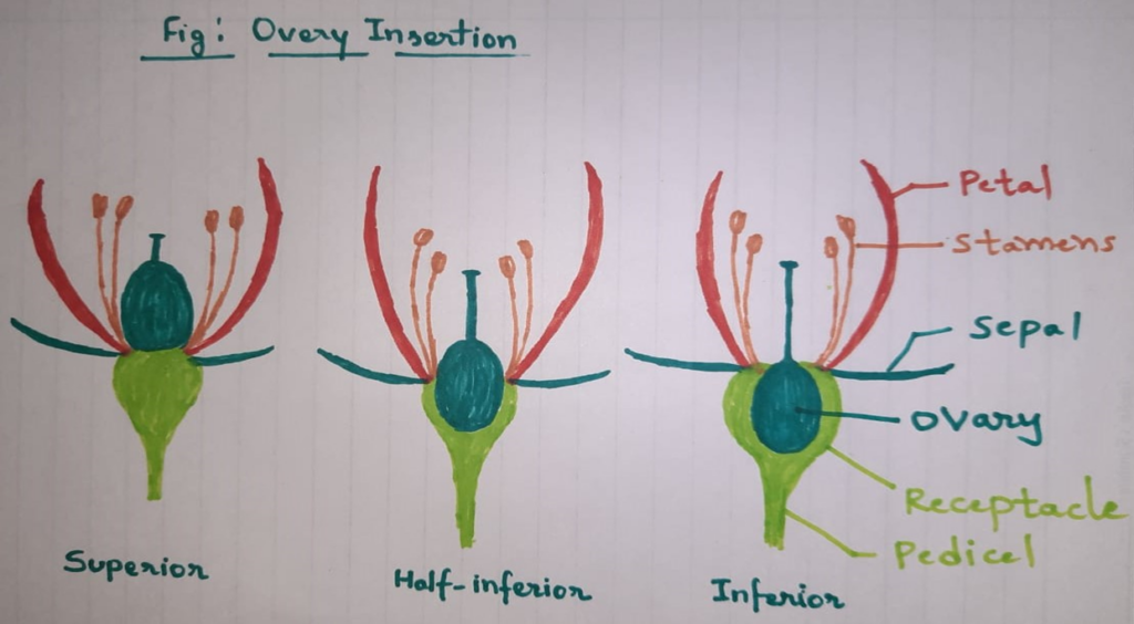 Overy Insertion, Superior overy, Inferior Overy